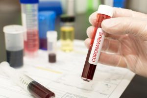 От 18 януари влиза в сила изискването за тест за коронавирус за пътуващите от България към Англия и Шотландия