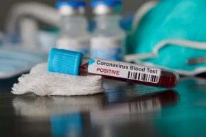 3860 нови положителни проби за коронавирус в страната